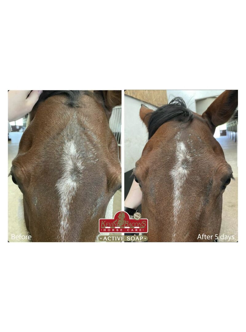 Jabón Anti Picor Kevin Bacon’s – Active Soap